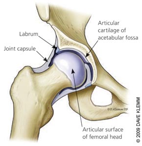 Hip and Groin Pain Hip Pain